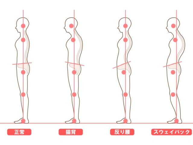 自律神経失調症に姿勢改善は効果がある！ 姿勢改善で体内循環を正常に
