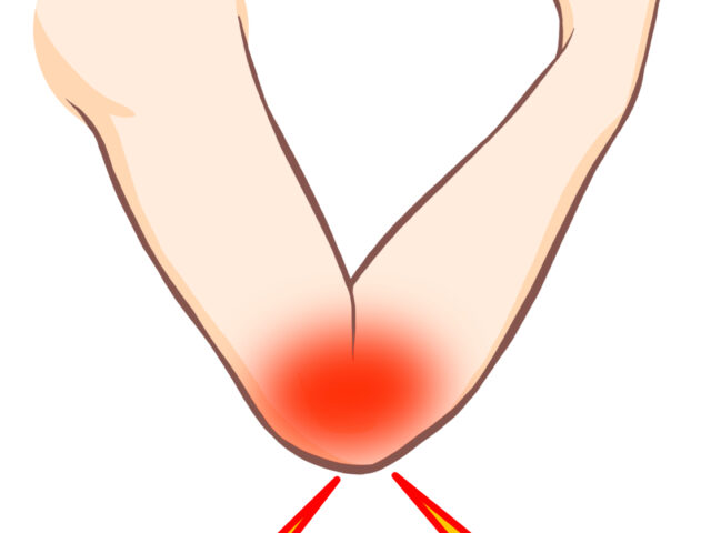 【川崎 整体院】抱っこ・家事でも起こる“テニス肘”｜ゼロ整体で根本改善をサポート